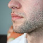 髭脱毛の方法は大きく分けて５種類！効果・値段それぞれの特徴を徹底解説